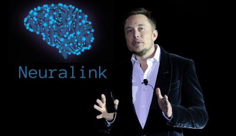 Neuralink 