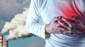 Air-Pollution-Increases-Risk-of-Atherosclerosis-and-Arterial-Damage