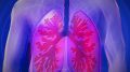Artificial Intelligence Can Help Detect Lung Cancer Even in the Early Stages