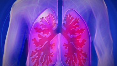 Artificial Intelligence Can Help Detect Lung Cancer Even in the Early Stages